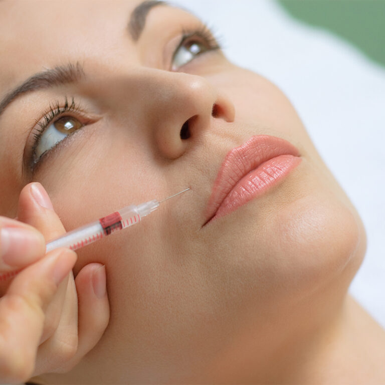 dermal fillers for lips