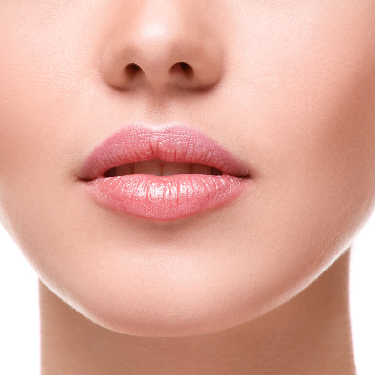 dermal fillers for lips