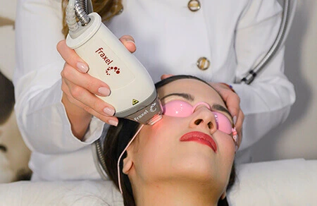 Fraxel Skin Resurfacing in Toronto, ON | Renovo Medical Spa