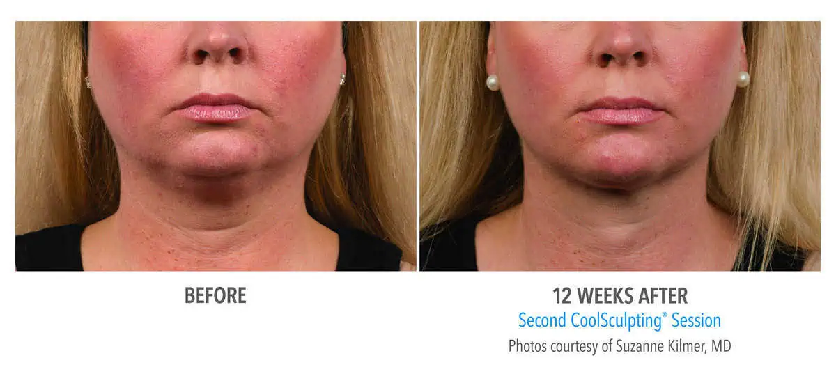 a comparison of a woman's face