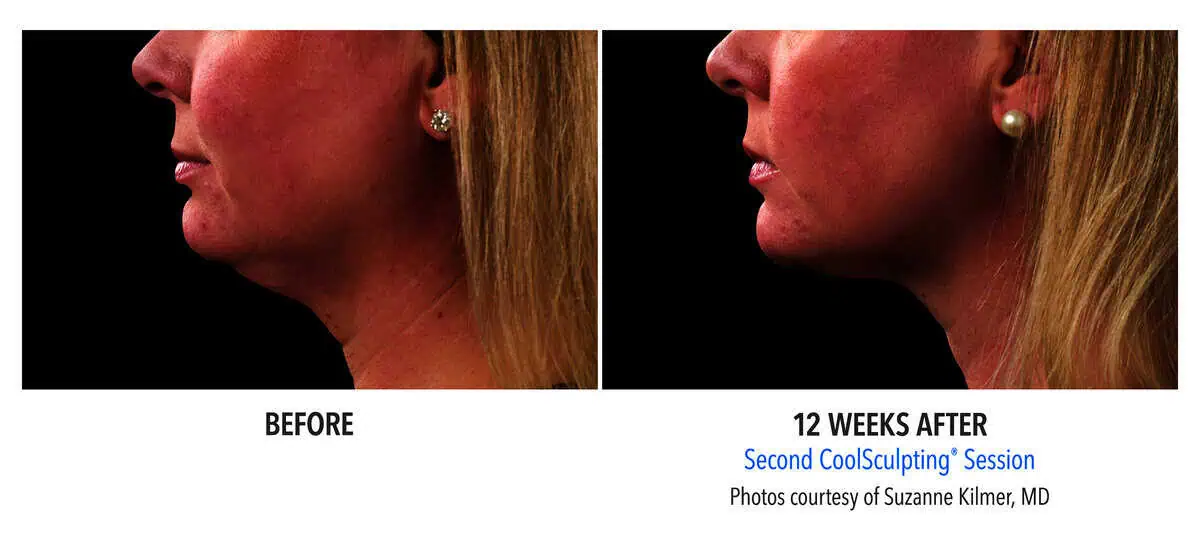 a comparison of a woman's face