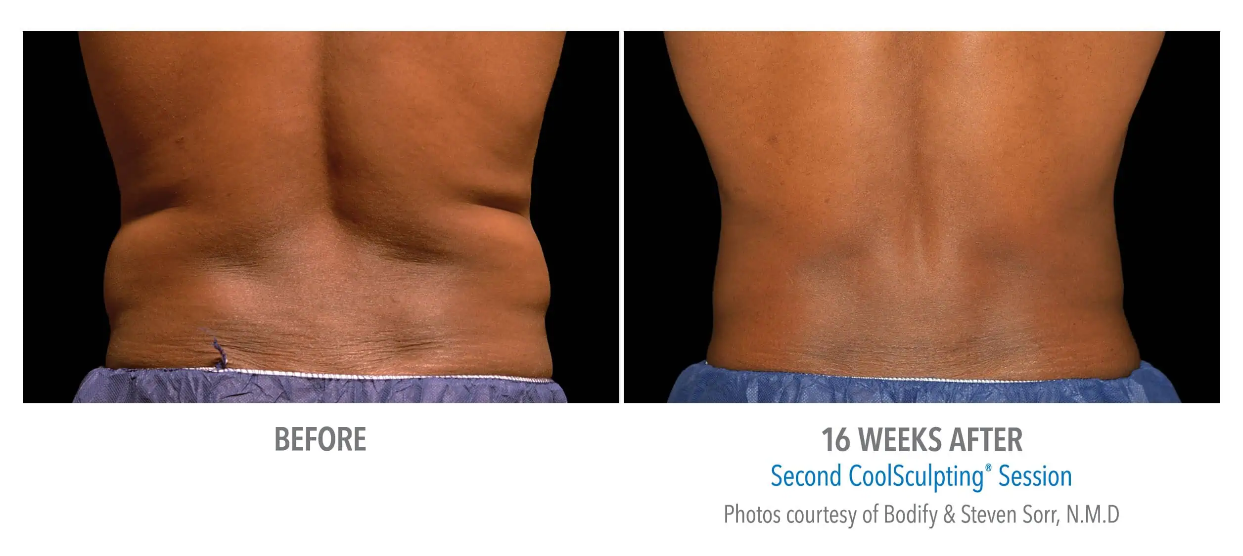 Male-Flanks-Back-View-Bodify-and-Steven-Sorr (1)